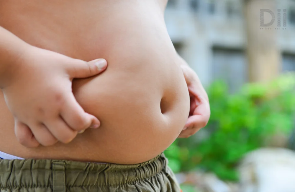 ประเภทพุง