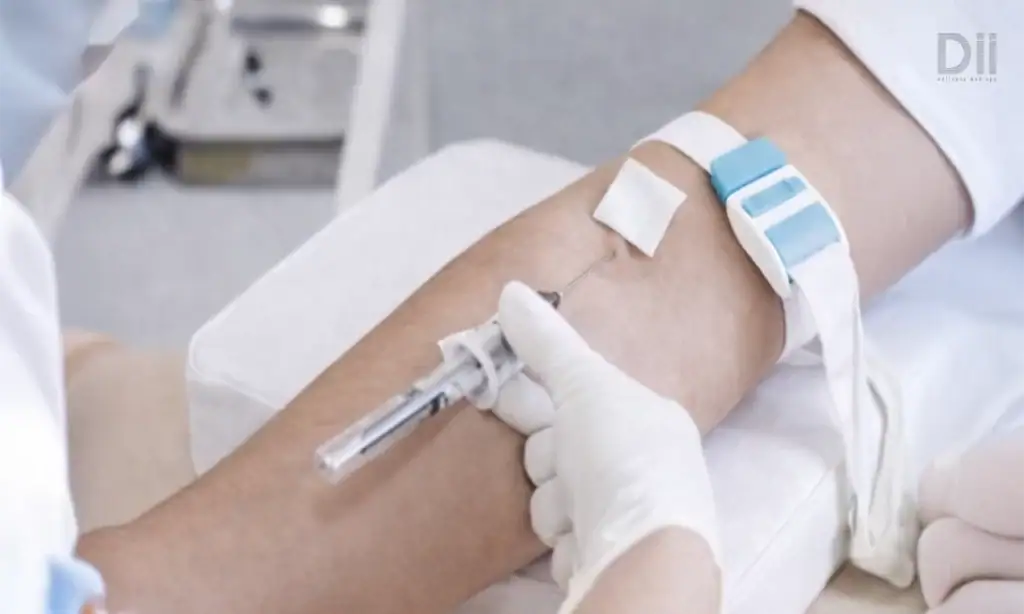 โปรแกรมคีเลชั่นบำบัด (Chelation Therapy)